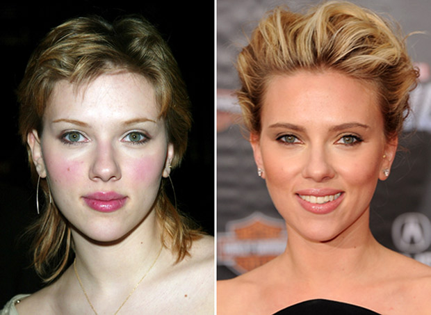Chirurgia Estetica Naso VIP: Scarlett Johansson